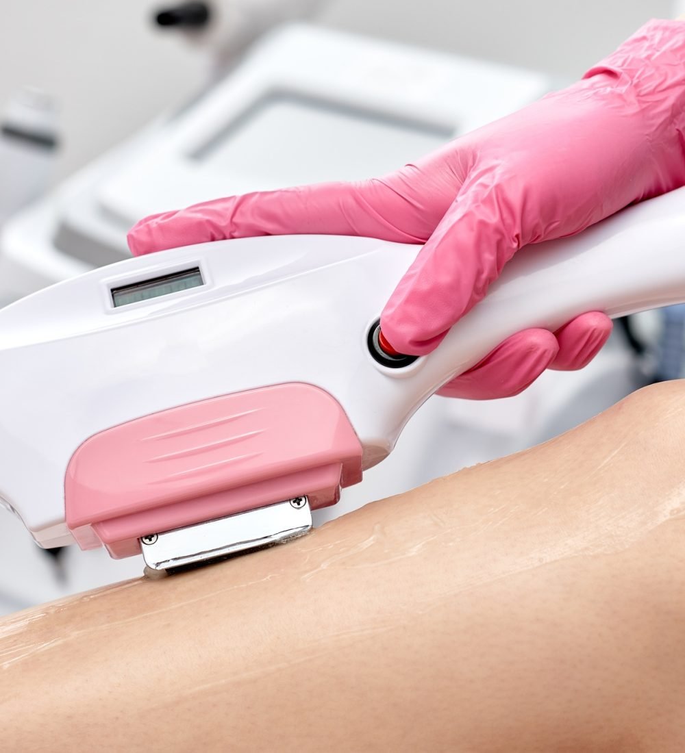 Laser depilation or photoepilator process on a woman leg.